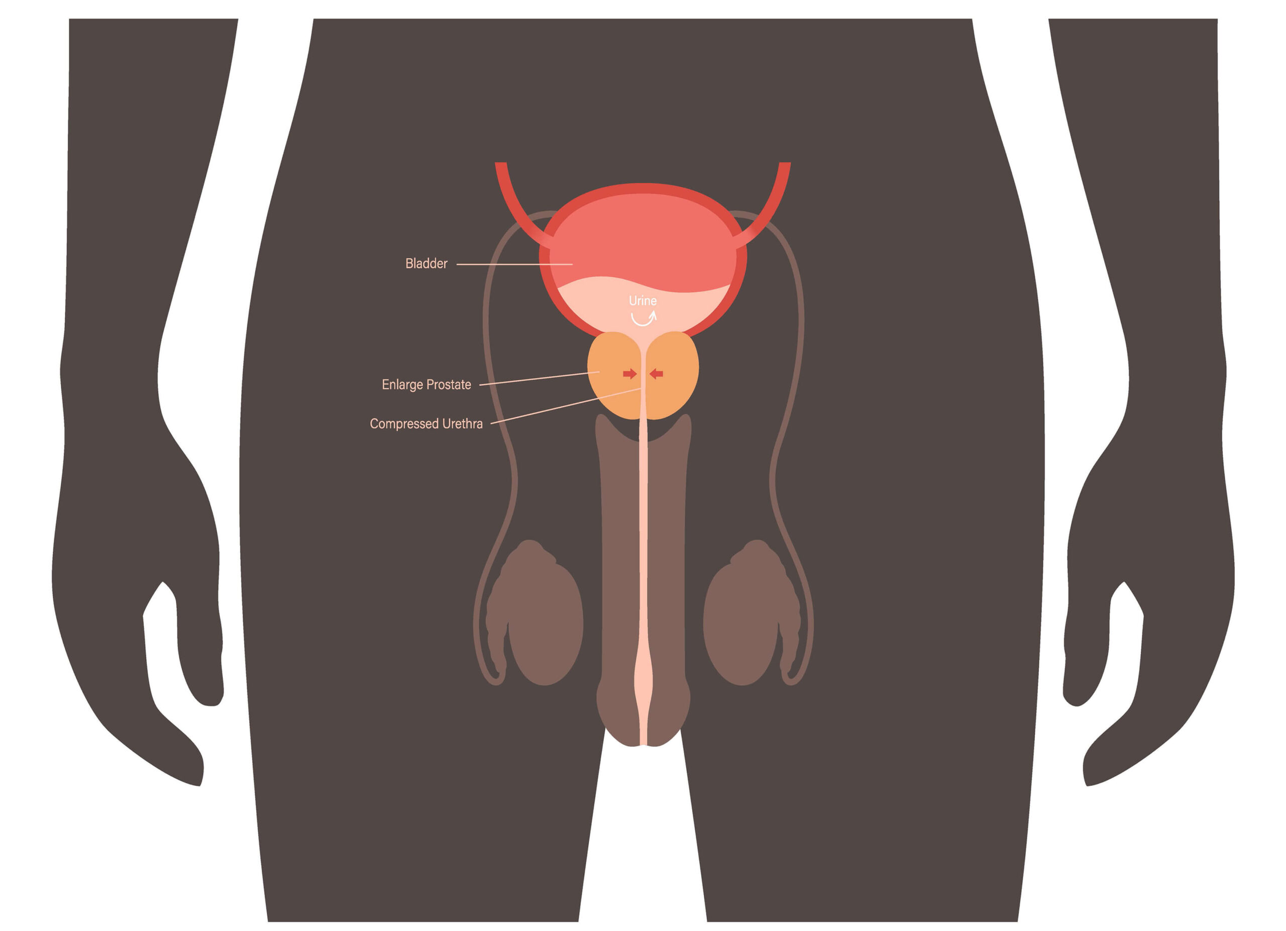 bladder
