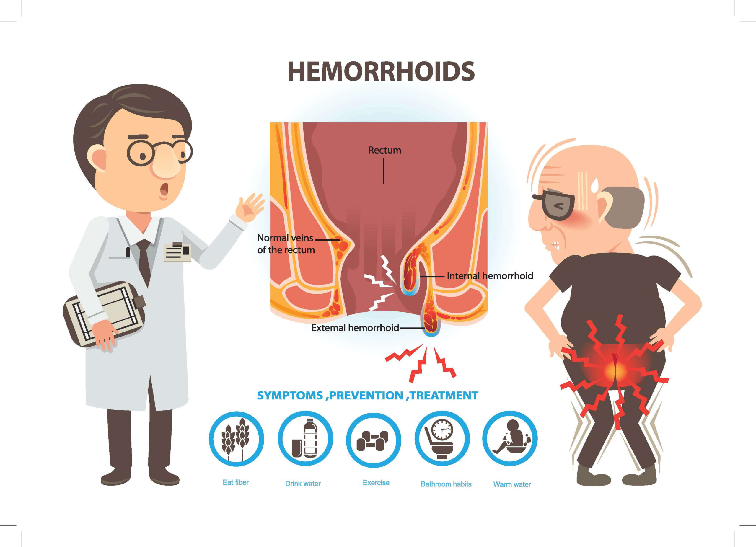 hemorrhoids