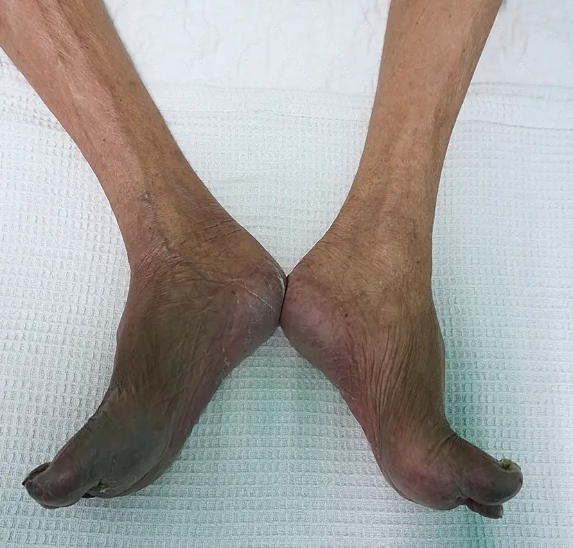 podiatry